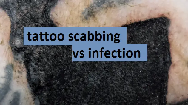 tattoo scabbing vs infection
